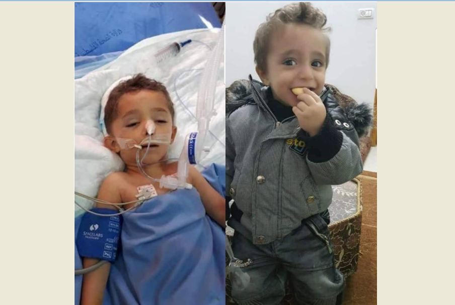 وفاة طفل متأثرًا بإصابته بعد وقوع تلفاز عليه جنوب جنين