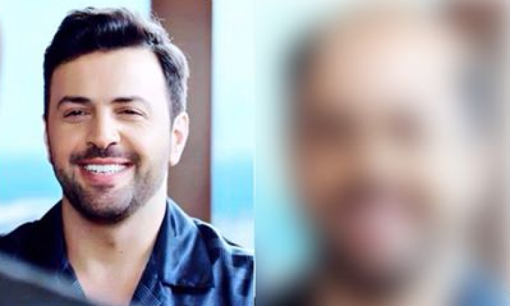 بالصور : 'كارثية' ماذا لو كان نجومنا العرب يعانون من الصلع‎‎؟