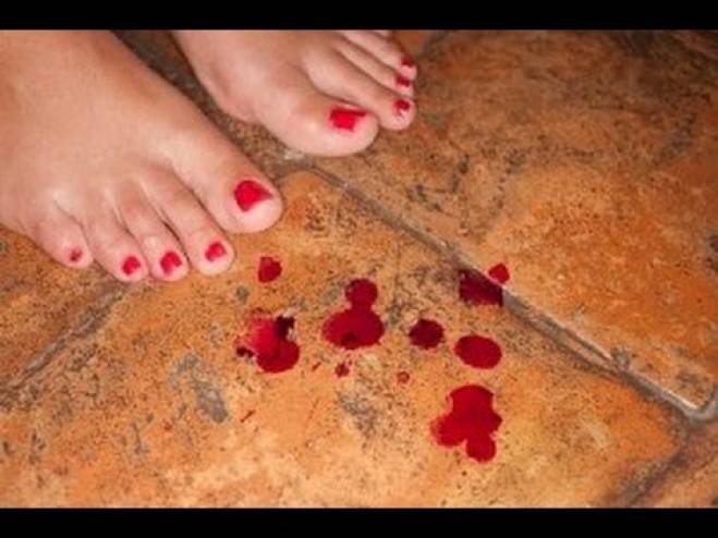 أنقذوا النساء من هذه الكارثة!