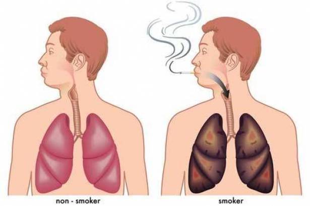 “مشروب طبيعي” يطهّر الرئتين من آثار التدخين!