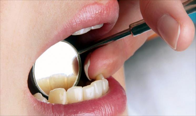 أمراض اللثة تفاقم خطر الإصابة بسرطان الثدي