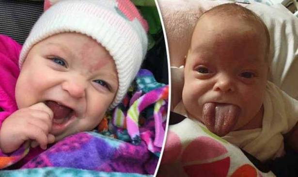 بالصورة: حالة نادرة تصدُم الأطباء ...