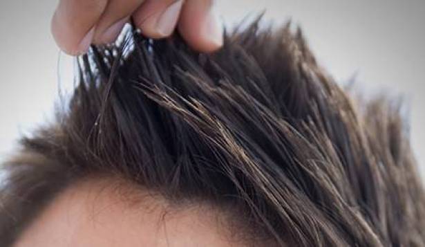 هل تستخدم الـ"جيل" للشعر؟ لهذه الاسباب.. توقف فورًا