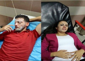 جيش الاحتلال يحرق طاقم فضائية اردنية في القدس اثناء تغطية ذكرى حرق ابو خضير