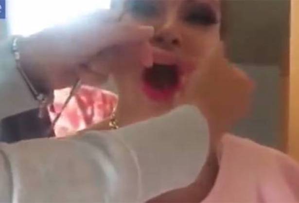 بالفيديو.. نجمة شهيرة تصدم الجمهور بنزع شفاهها الصناعية