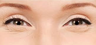 الأسباب والعلاج : ترهل الجلد حول العين