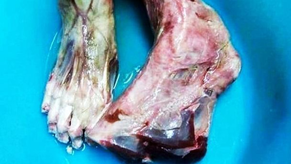 قدم بشرية مقطوعة في مطعم صيني.. تعرفوا على تفاصيل الصدمة؟