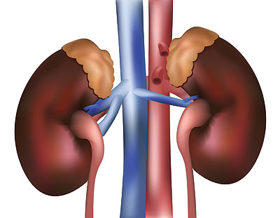 مجموعة متنوعة من الفيتامينات تحس وظائف الكلى