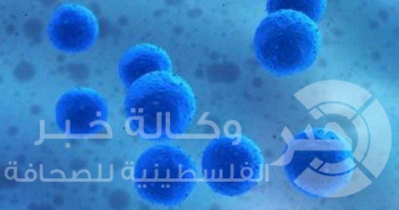 وداعاً لهشاشة العظام