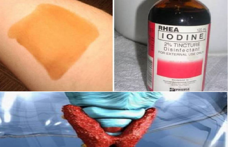 تأكّدوا من أن غدّتكم الدرقية تتلقّى الكمية الكافية من اليود