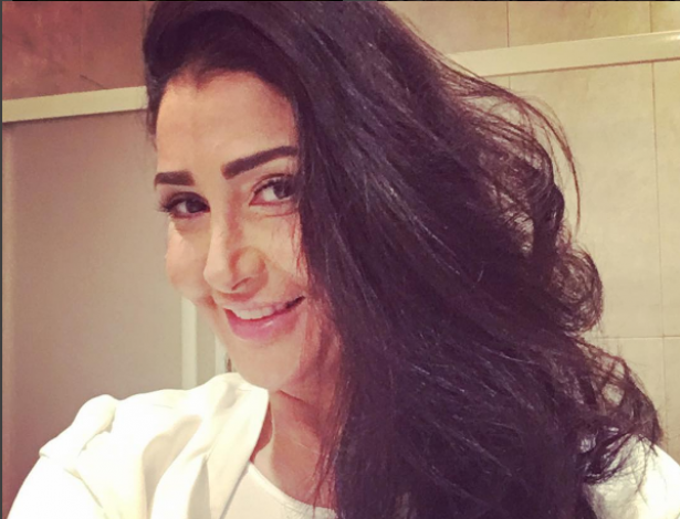 بالصور: هذا ما حدث لوجه غادة عبدالرازق