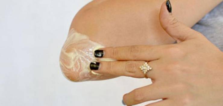 وصفة منزليّة للتخلّص من تشقّقات الكوع