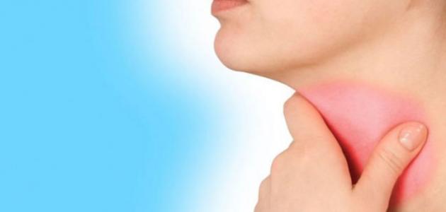 كيفية علاج بحة الصوت