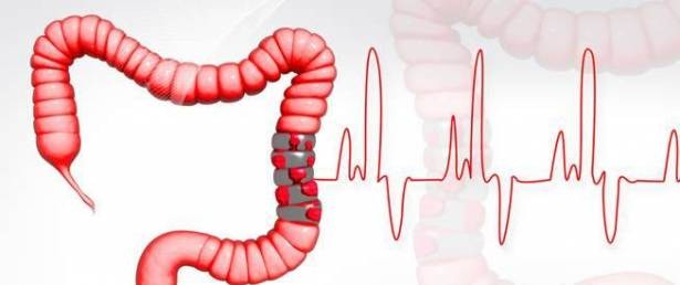 نصائح لمرضى التهاب الأمعاء في شهر رمضان!