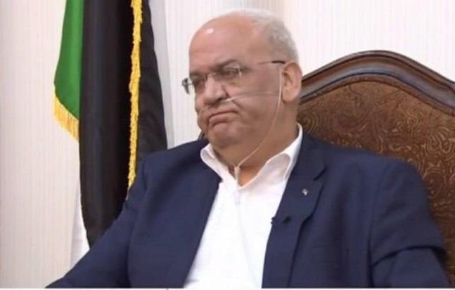 نجاح عملية زراعة رئة أجراها "عريقات" في أحد مشافي أمريكا 