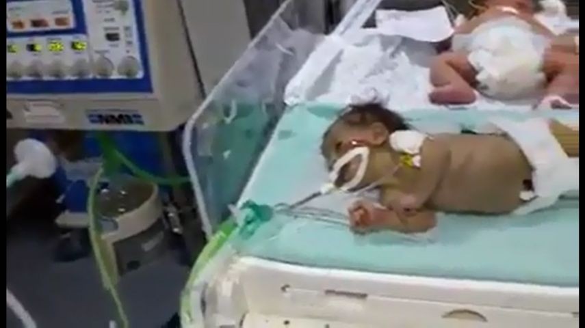 وفاة طفلة من غزة بعد منعها من السفر للعلاج