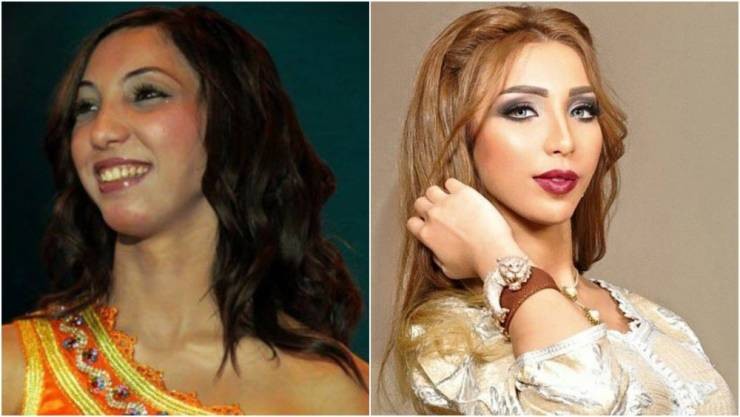  النجمة 'دنيا بطمة' تفاجئ متابعيها بما قالته بهذا الخصوص!