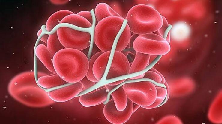 أطعمة تزيد من مستوى الهيموغلوبين في الدم