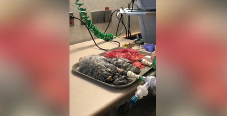 بالفيديو : اليكم الفرق بين رئتك ورئة شخص آخر لا يُدخن!!