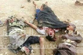 مناشدة لإجلاء جثث القتلى من شوارع اليمن