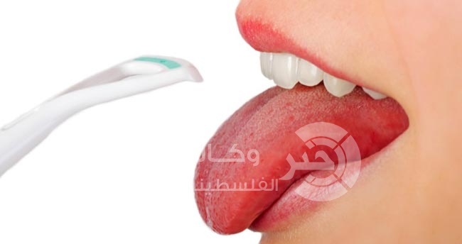 ماذا عن تغير لون اللسان