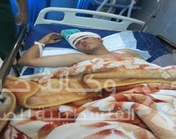 مستشفيات عدن تستقبل أعدادا ً كبيرة من الجرحى