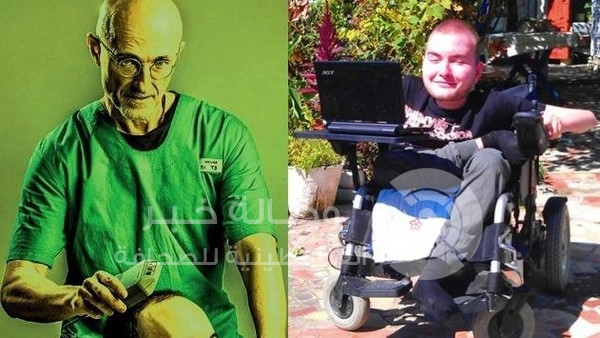 جراح إيطالي يقطع رأس مهندس كمبيوتر روسي وزرعه في جسد آخر