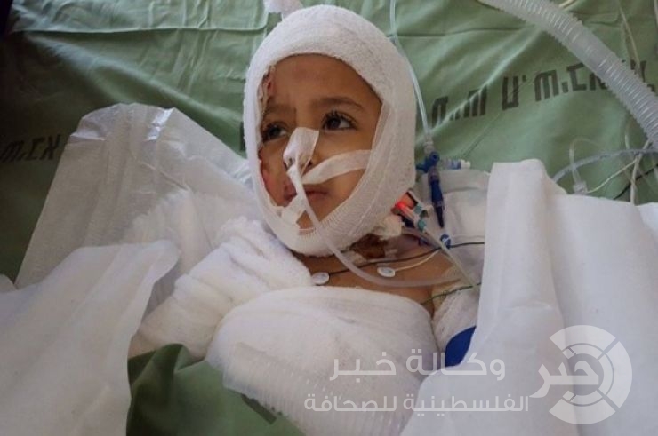 بالفيديو والتفاصيل : الطفل دوابشة يكرر السؤال عن والديه والأطباء يؤكدون نحتاج لعام كامل لعلاج والدته "مشاهد مبكية"