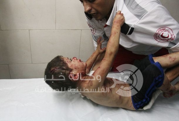 اطباء بلا حدود: اطفال غزة المصابين في الحرب ما زالوا يعالجون