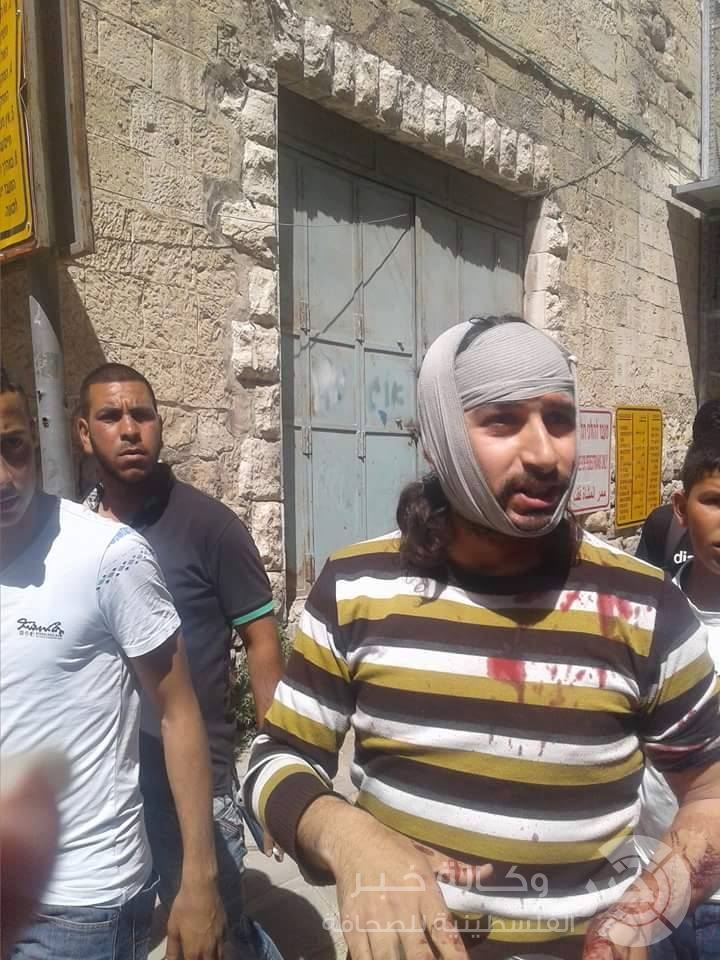 بالصور: إصابات في صفوف المواطنين نتيجة اعتداء مستوطنون متطرفون عليهم في الخليل